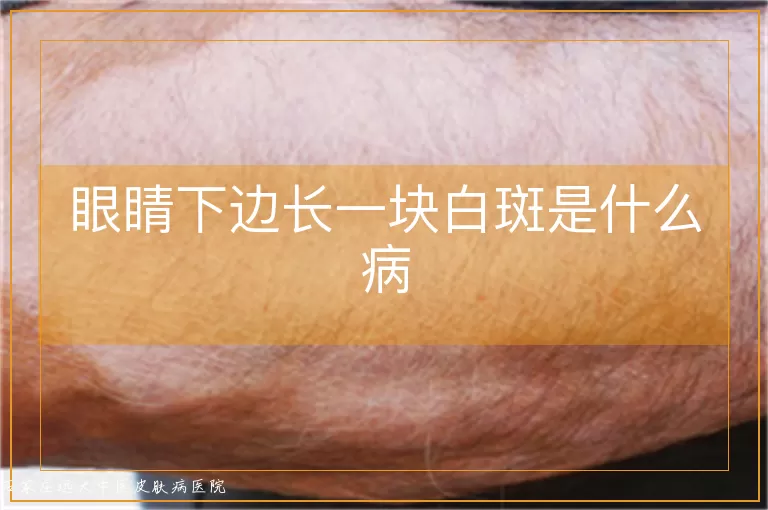 眼睛下边长一块白斑是什么病