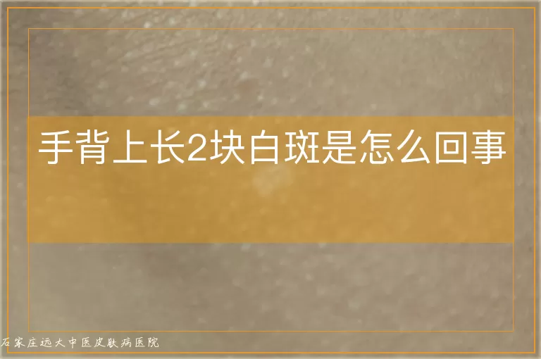 手背上长2块白斑是怎么回事