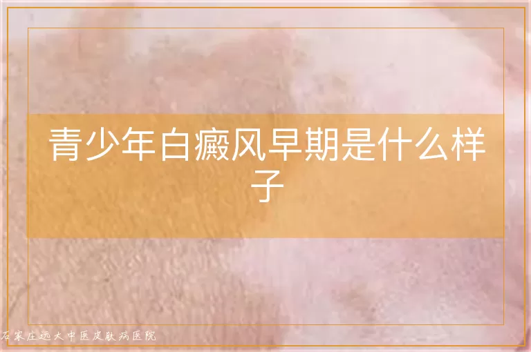 青少年白癜风早期是什么样子