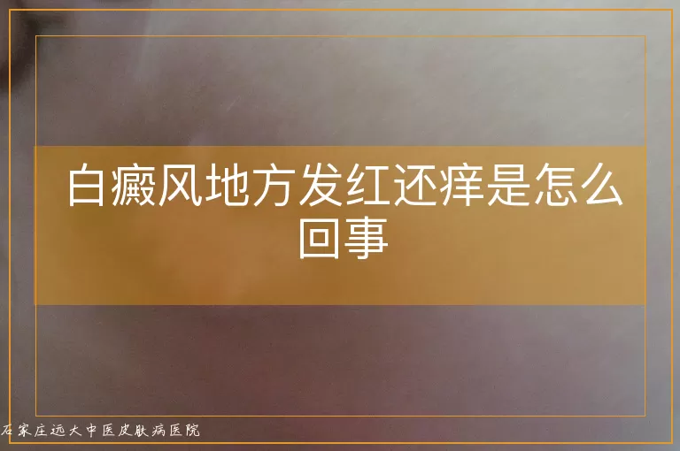 白癜风地方发红还痒是怎么回事