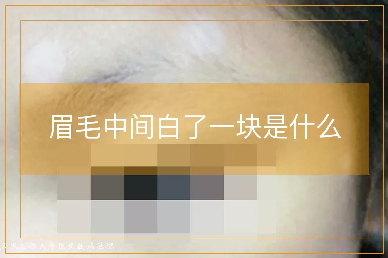 眉毛中间白了一块是什么