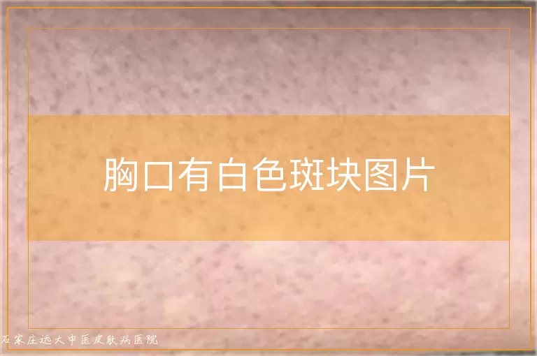 胸口有白色斑块图片