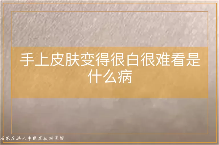 手上皮肤变得很白很难看是什么病