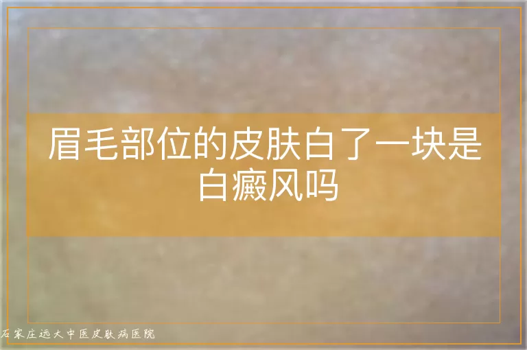 眉毛部位的皮肤白了一块是白癜风吗