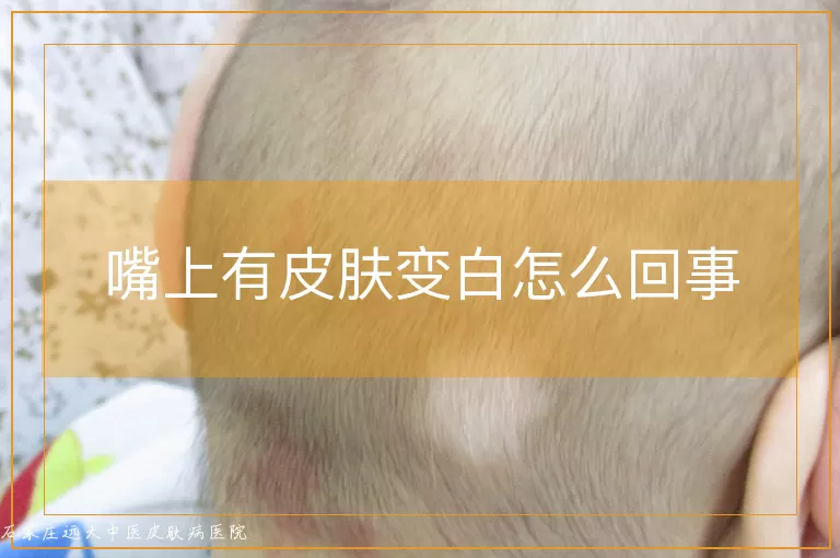 嘴上有皮肤变白怎么回事