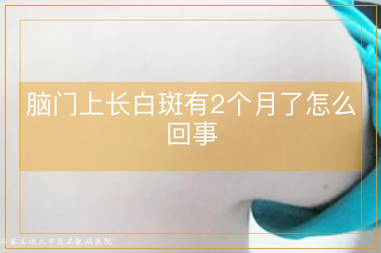 脑门上长白斑有2个月了怎么回事