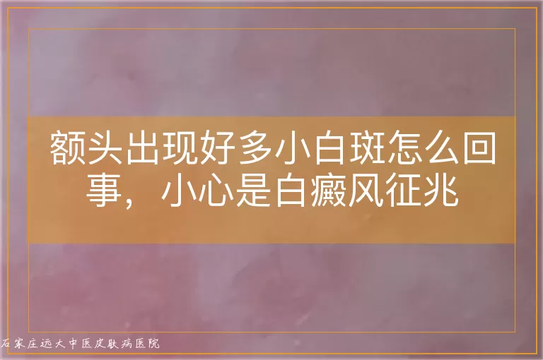 额头出现好多小白斑怎么回事,小心是白癜风征兆