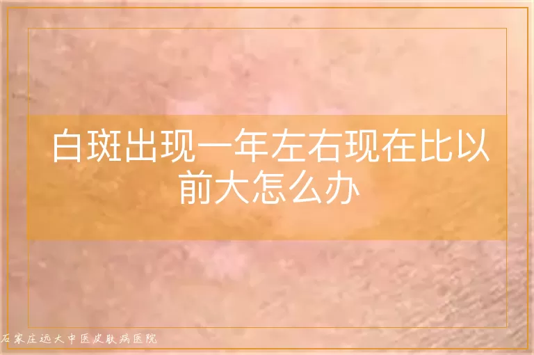 白斑出现一年左右现在比以前大怎么办