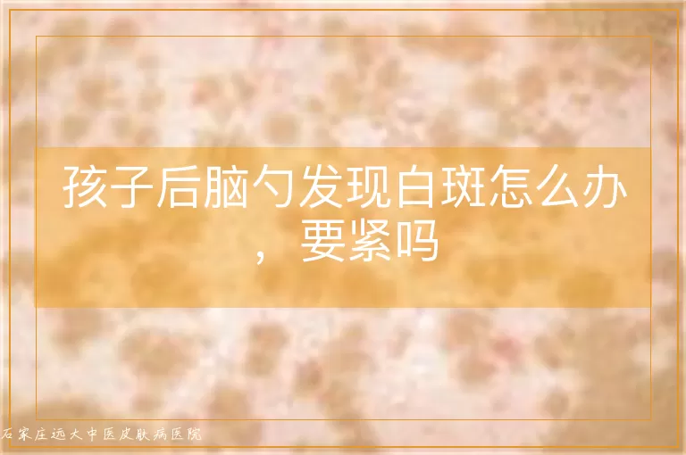 孩子后脑勺发现白斑怎么办，要紧吗