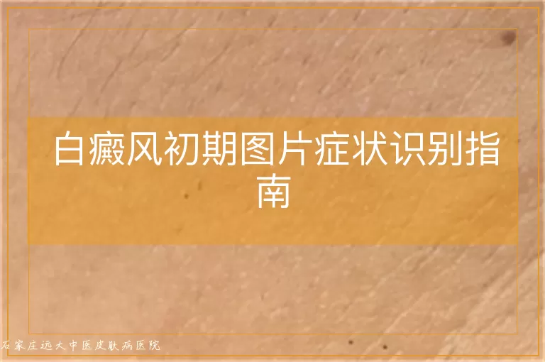 白癜风初期图片症状识别指南