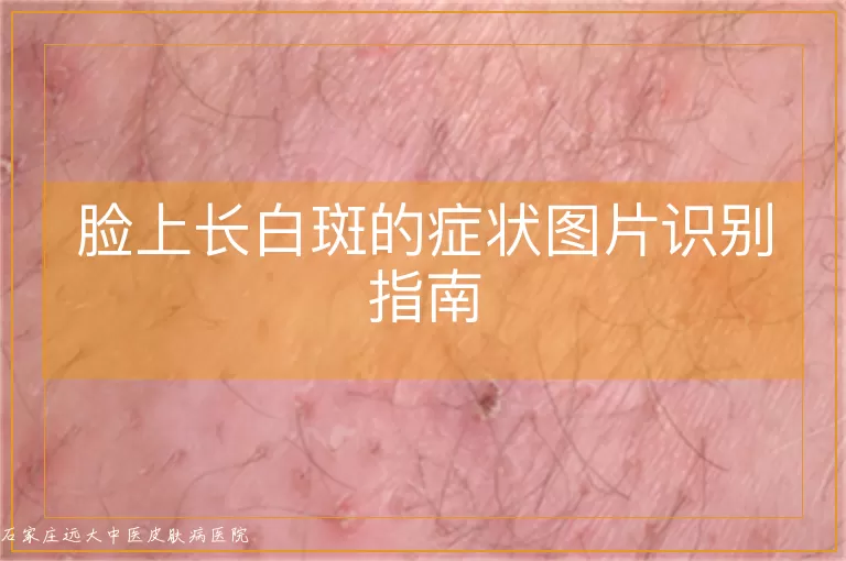 脸上长白斑的症状图片识别指南
