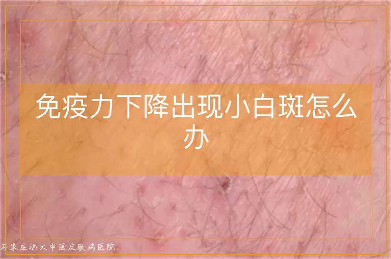 免疫力下降出现小白斑怎么办