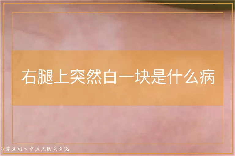 右腿上突然白一块是什么病