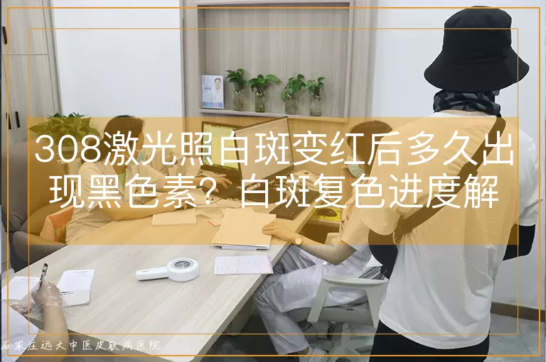 308激光照白斑变红后多久出现黑色素?白斑复色进度解读