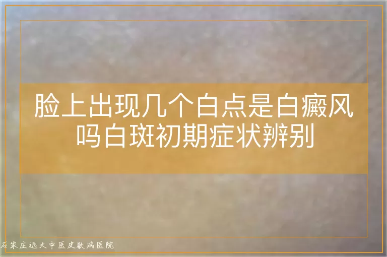 脸上出现几个白点是白癜风吗白斑初期症状辨别