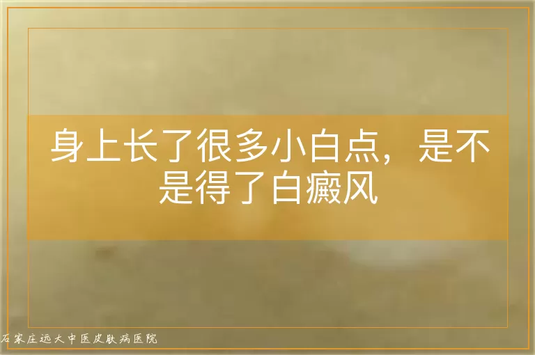 身上长了很多小白点,是不是得了白癜风