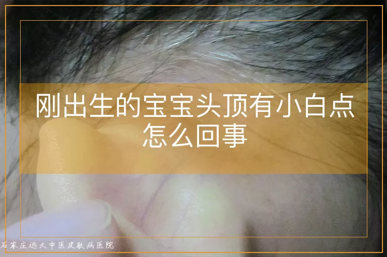 刚出生的宝宝头顶有小白点怎么回事