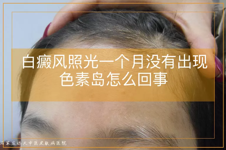 白癜风照光一个月没有出现色素岛怎么回事
