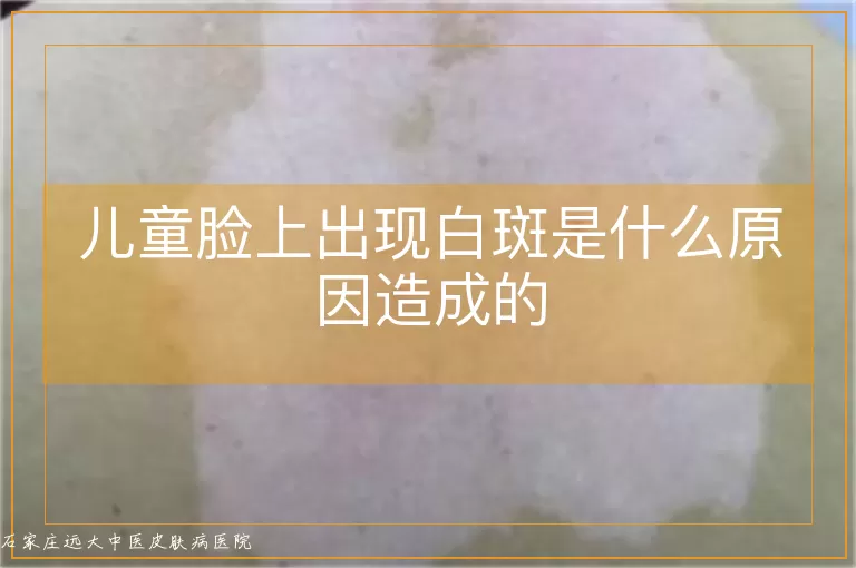 儿童脸上出现白斑是什么原因造成的