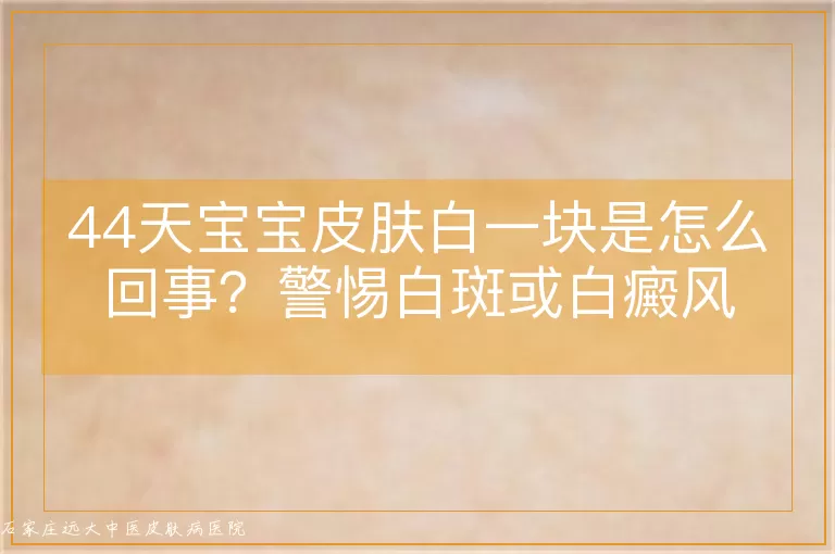 44天宝宝皮肤白一块是怎么回事?警惕白斑或白癜风