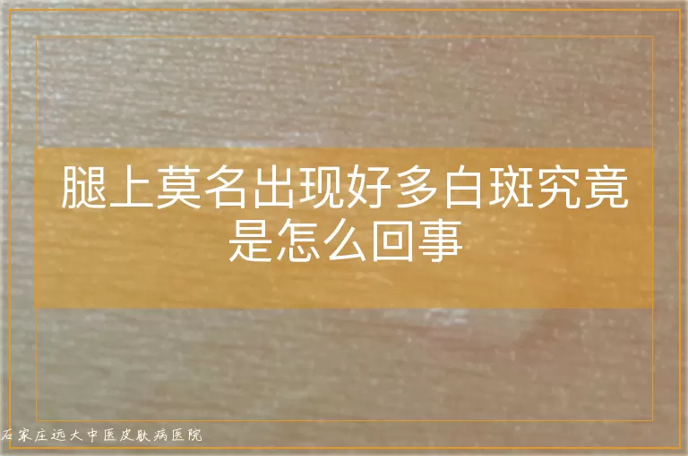 腿上莫名出现好多白斑究竟是怎么回事