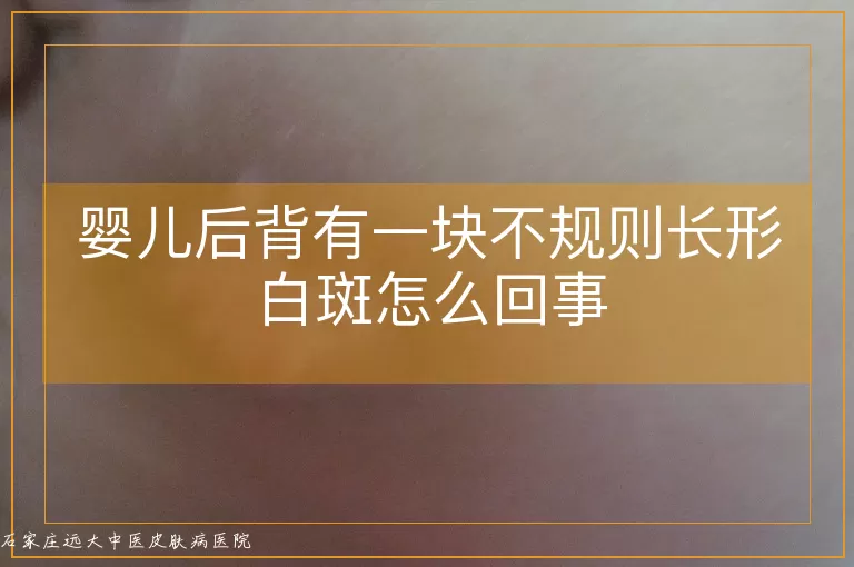 婴儿后背有一块不规则长形白斑怎么回事