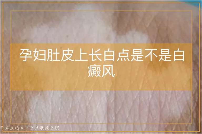 孕妇肚皮上长白点是不是白癜风