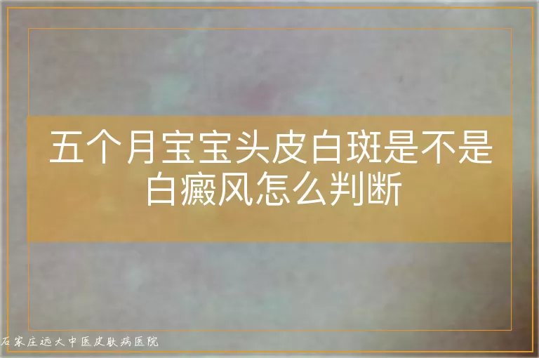 五个月宝宝头皮白斑是不是白癜风怎么判断