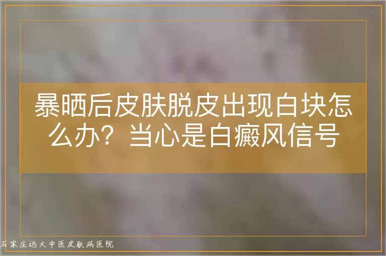 暴晒后皮肤脱皮出现白块怎么办？当心是白癜风信号