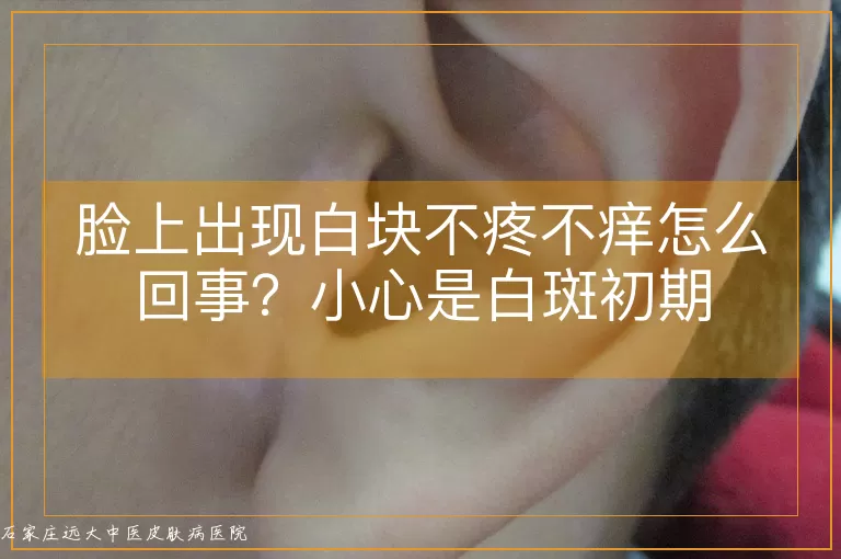 脸上出现白块不疼不痒怎么回事？小心是白斑初期