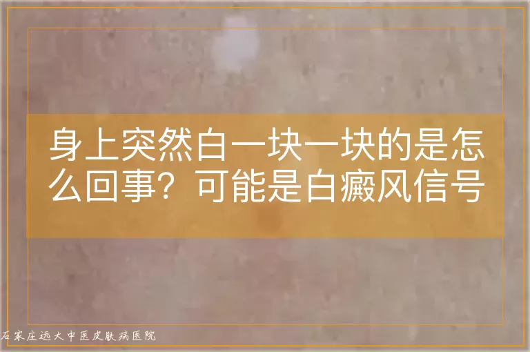 身上突然白一块一块的是怎么回事？可能是白癜风信号