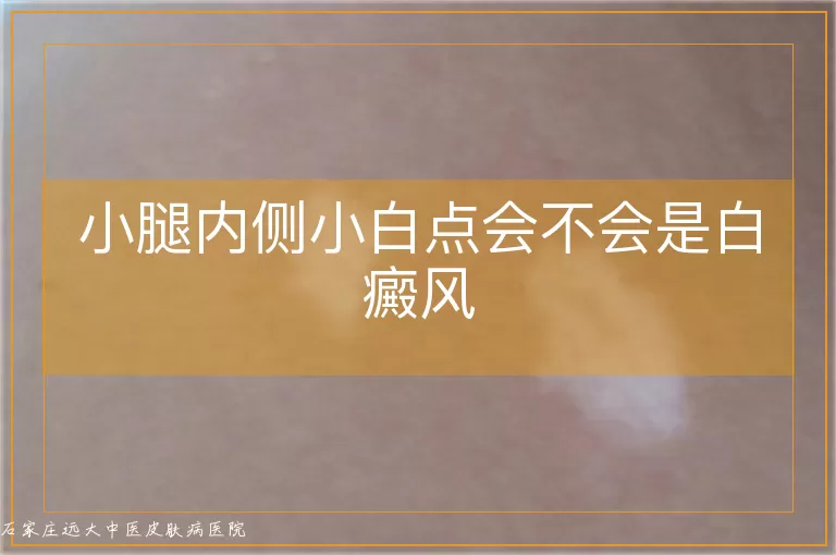 小腿内侧小白点会不会是白癜风