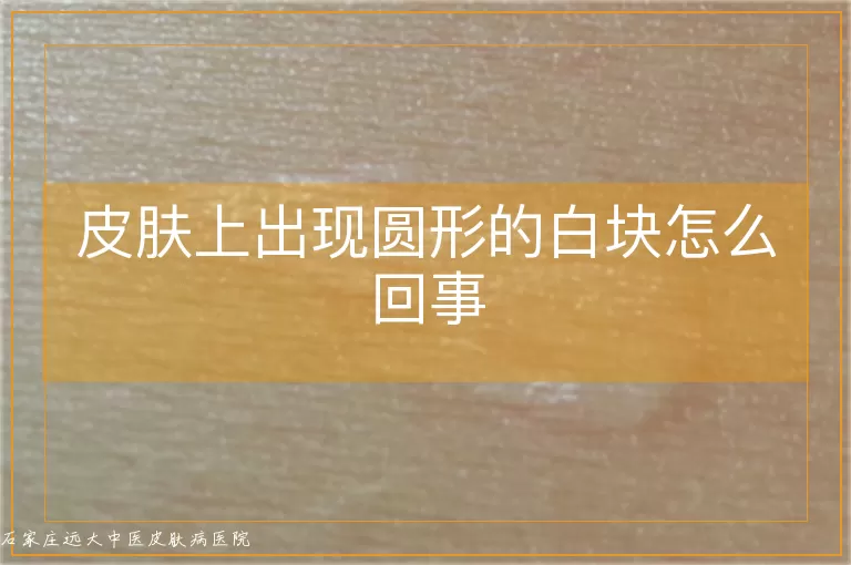 皮肤上出现圆形的白块怎么回事