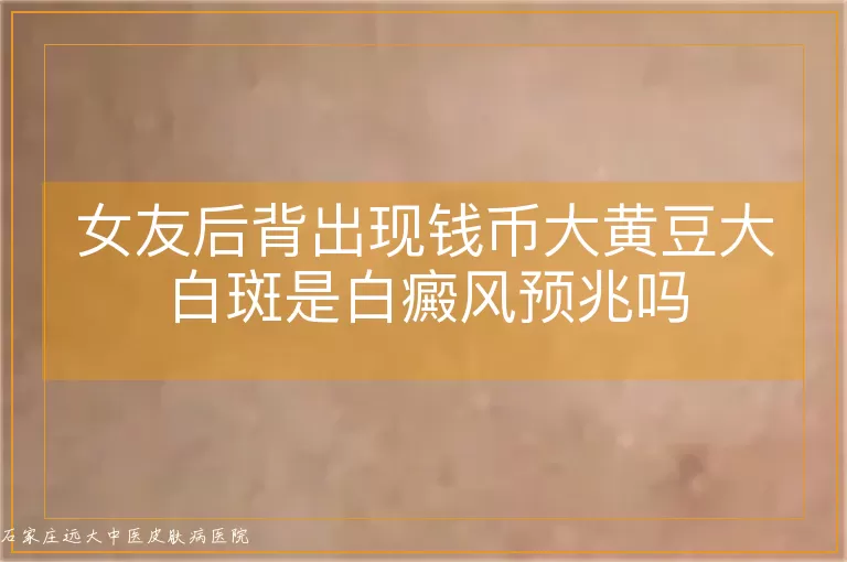 女友后背出现钱币大黄豆大白斑是白癜风预兆吗