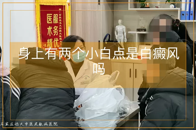 身上有两个小白点是白癜风吗