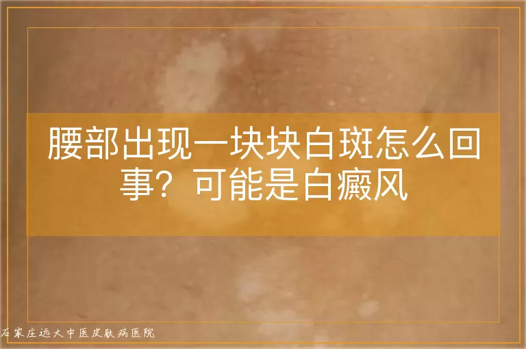 腰部出现一块块白斑怎么回事?可能是白癜风
