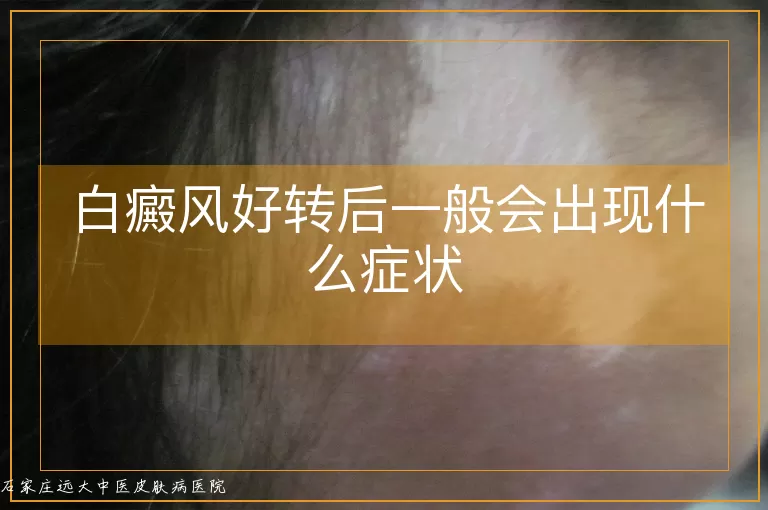 白癜风好转后一般会出现什么症状