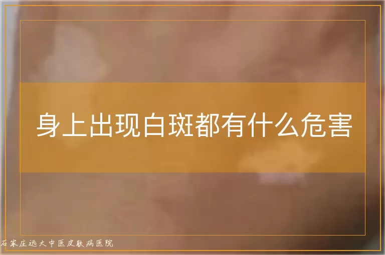 身上出现白斑都有什么危害