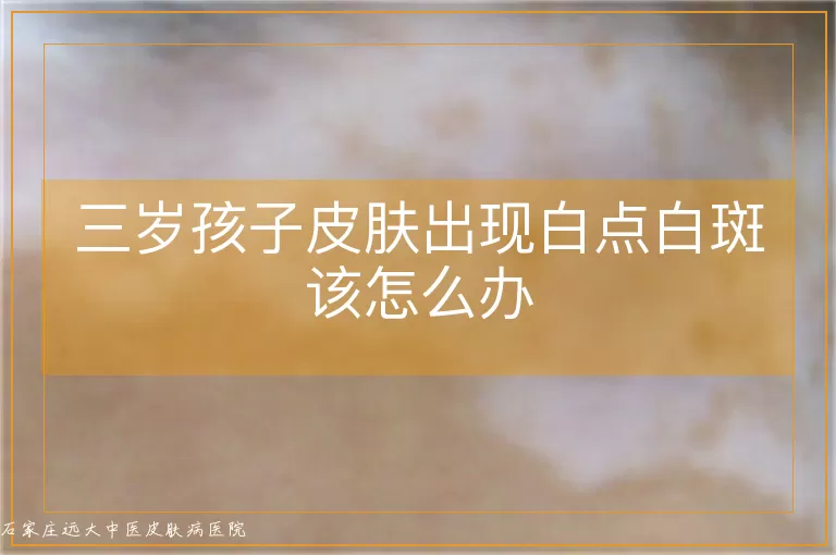 三岁孩子皮肤出现白点白斑该怎么办