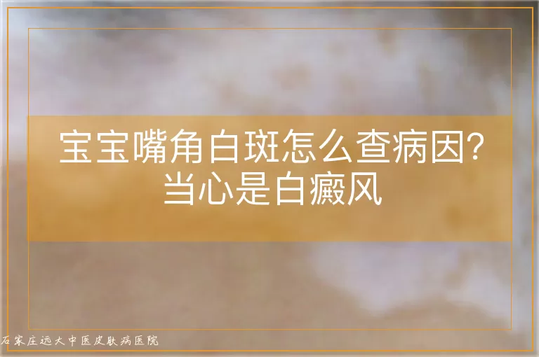 宝宝嘴角白斑怎么查病因?当心是白癜风