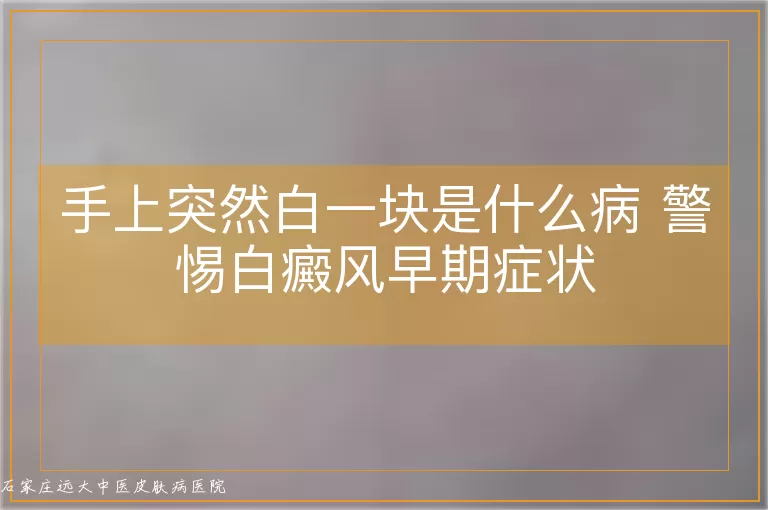 手上突然白一块是什么病 警惕白癜风早期症状