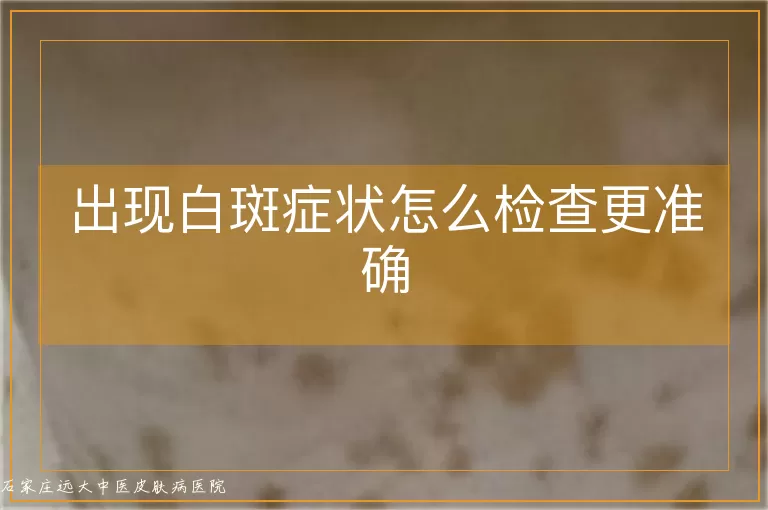 出现白斑症状怎么检查更准确