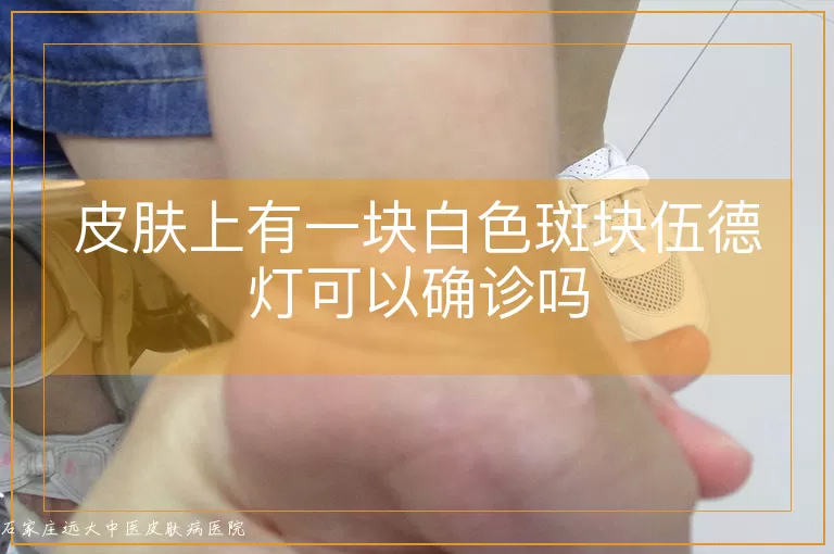 皮肤上有一块白色斑块伍德灯可以确诊吗