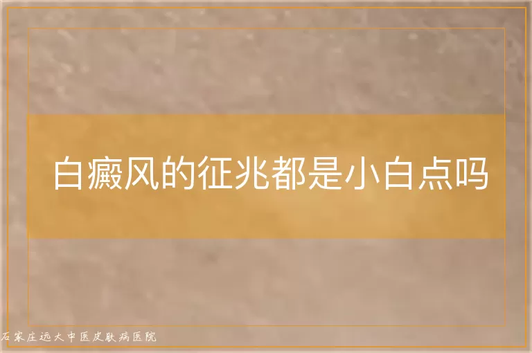 白癜风的征兆都是小白点吗