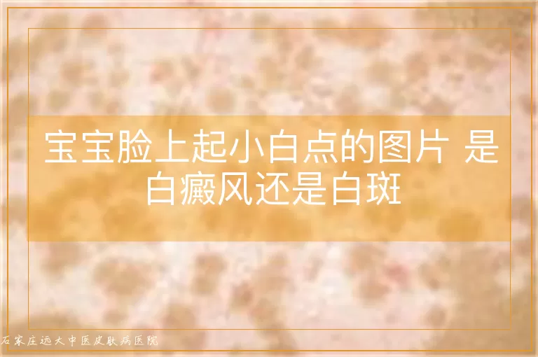 宝宝脸上起小白点的图片 是白癜风还是白斑