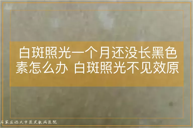 白斑照光一个月还没长黑色素怎么办 白斑照光不见效原因解析,白斑照光后没有黑色素怎样调整方案,白癜风照光一个月效果不明显该怎么做