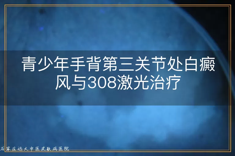 青少年手背第三关节处白癜风与308激光治疗