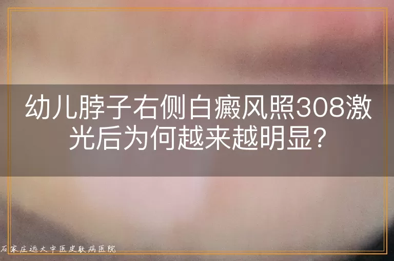 幼儿脖子右侧白癜风照308激光后为何越来越明显？