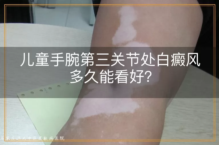 儿童手腕第三关节处白癜风多久能看好？