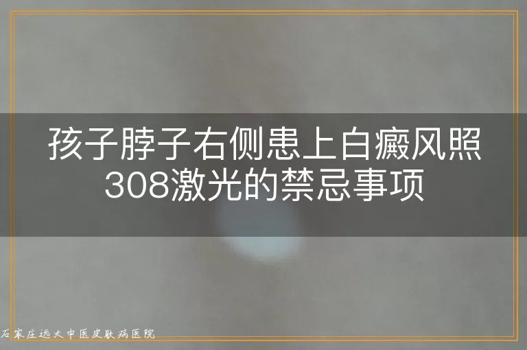 孩子脖子右侧患上白癜风照308激光的禁忌事项